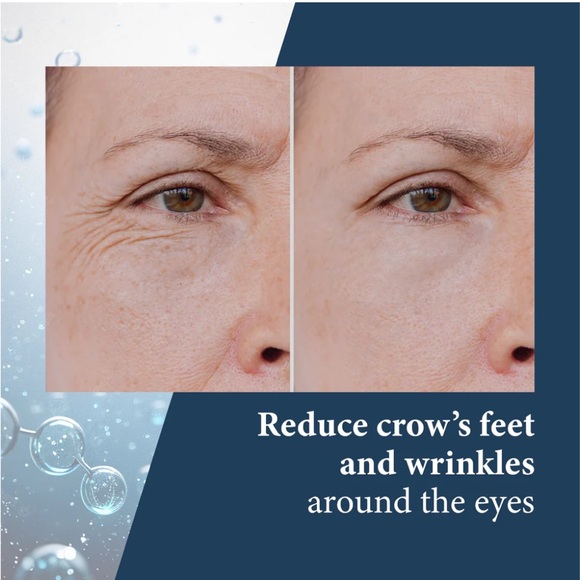 Eye Serum SkinPro Elite Serum 10 Growth Factor Anti aging Eye Serum - Picture 4 of 8